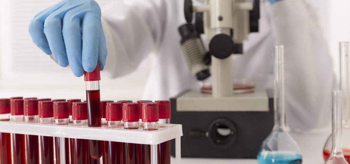 coronavirus-blood-samples-arrangement-lab