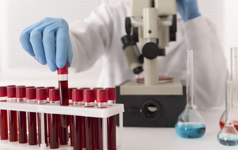 coronavirus-blood-samples-arrangement-lab